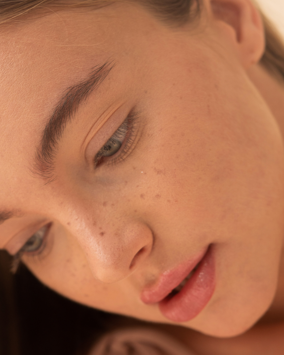 Freckles $150