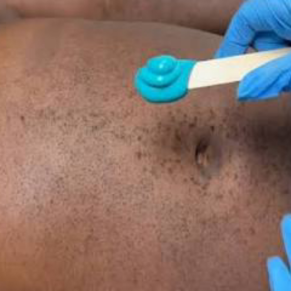 Stomach Wax (Full Stomach) at Pink Paradise Esthetics LLC in Mobile, AL