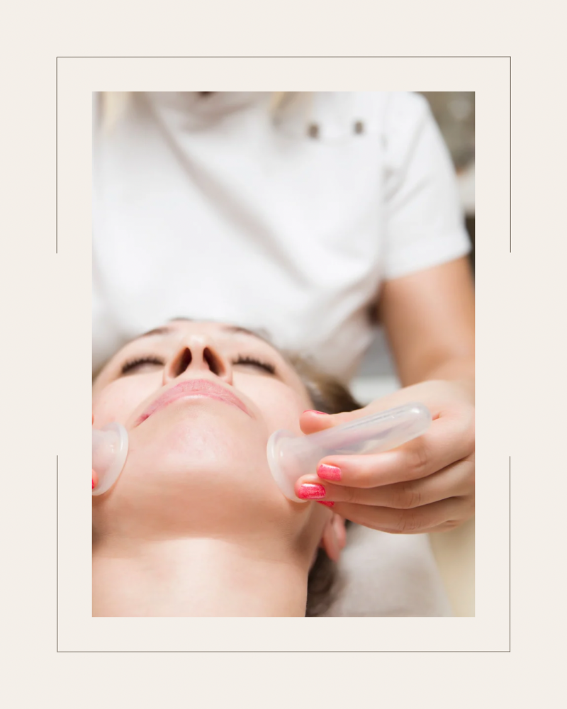 Facial Cupping