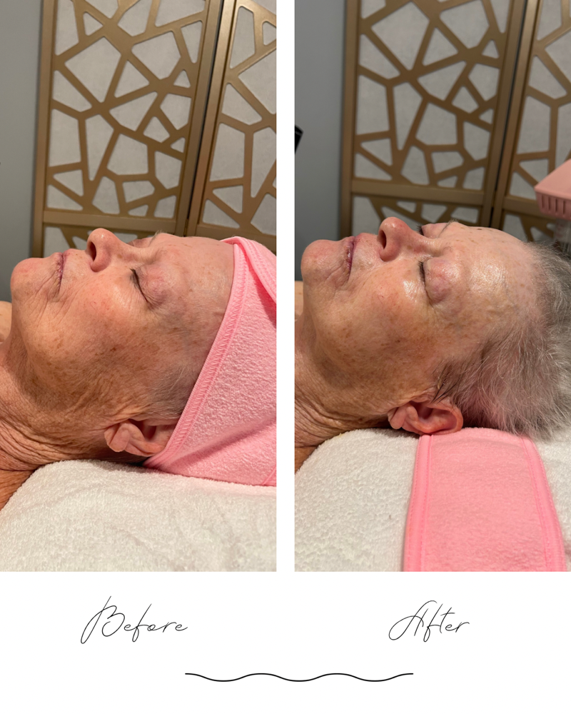 Luxe Lift (anti aging) facial