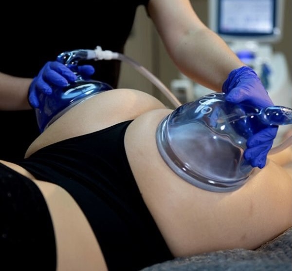Returning Client - Brazilian Butt Lift
