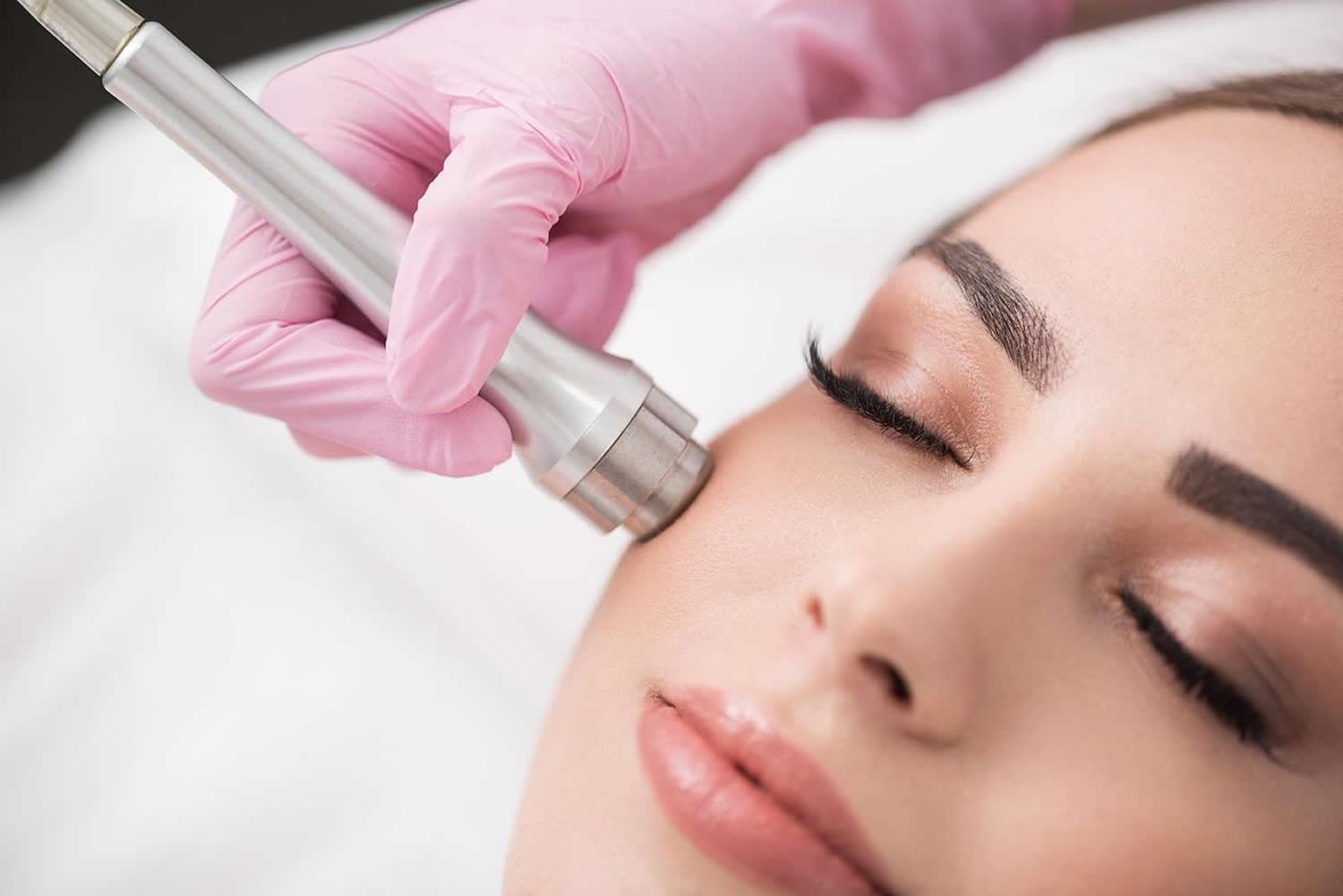 Microderm Facial