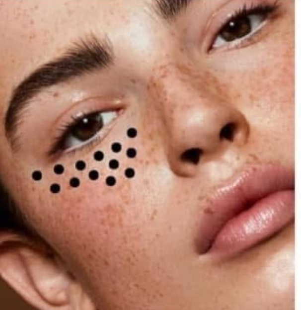 PN Undereye Dark Circle Treatment