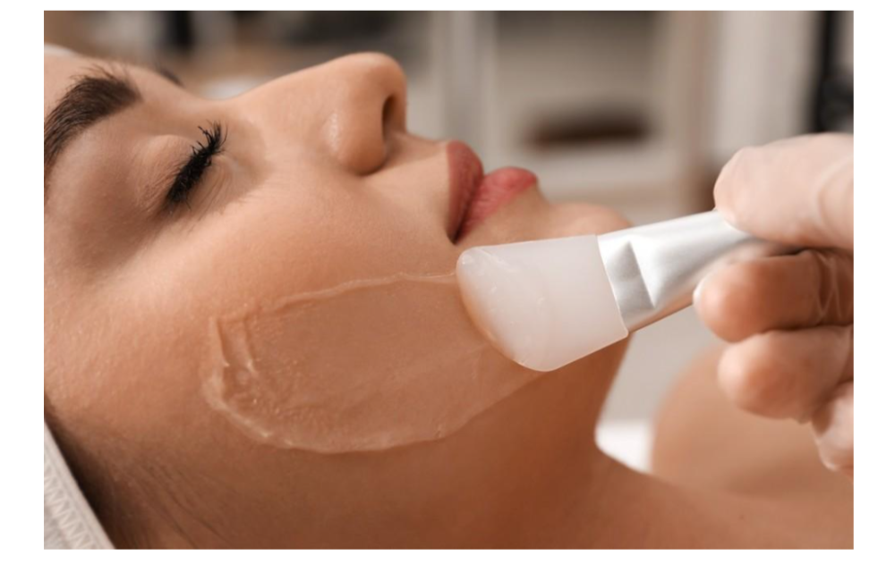 Chemical Peel
