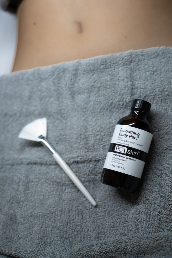 Foot Peel