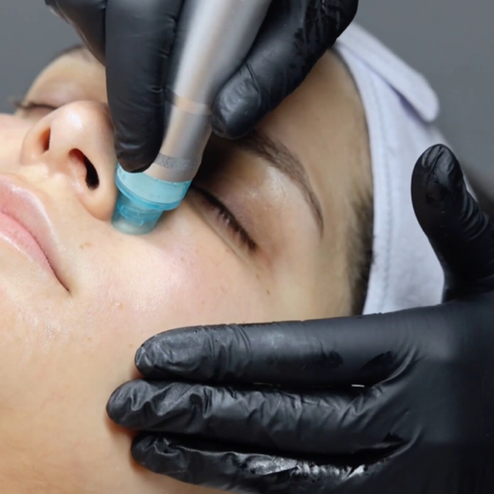 Personalized Consultation+Treatment at ILLUME Skin Studio in San Juan, PR