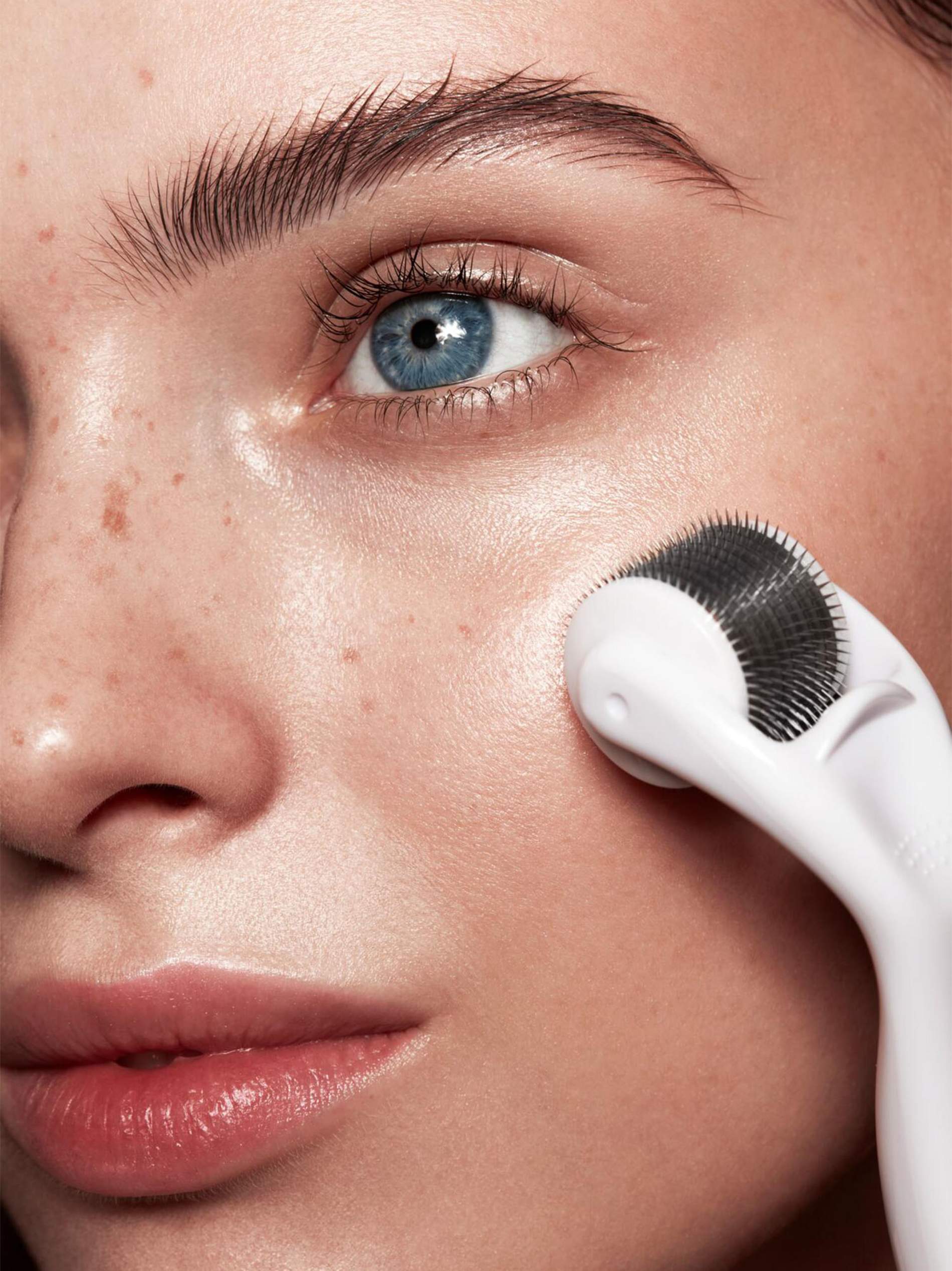 Microneedle