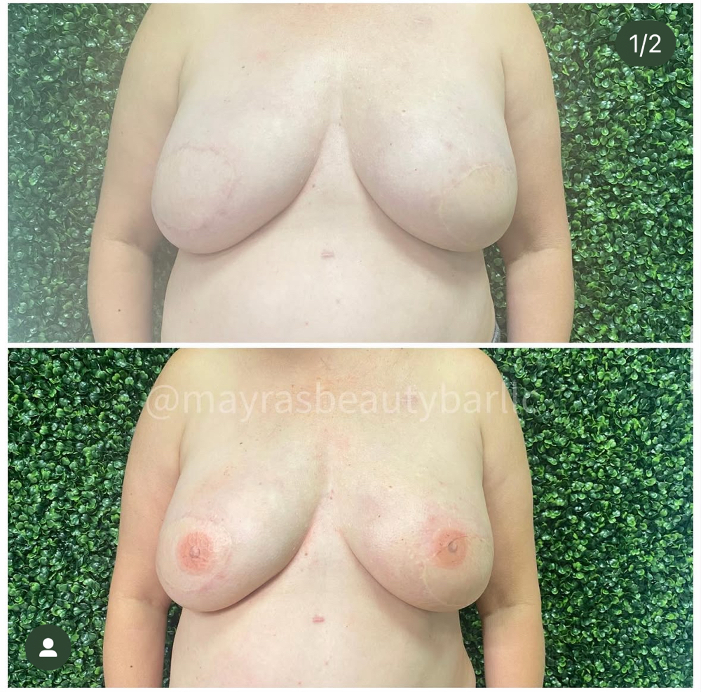 Areola Tattoo