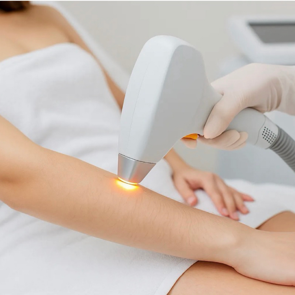 (IPL) Lower Arms at BEAUTY LAB COLLECTIVE in Miami, FL