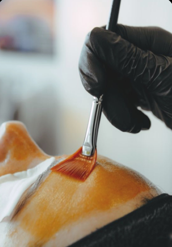 Mandeliclear Chemical Peel