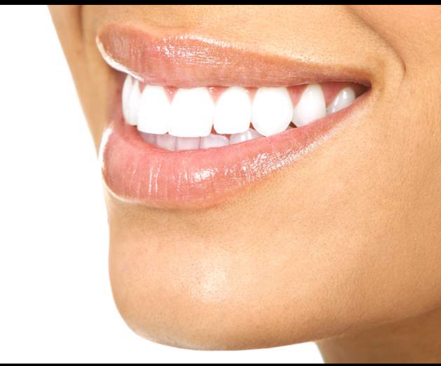 Teeth Whitening (Single Session)