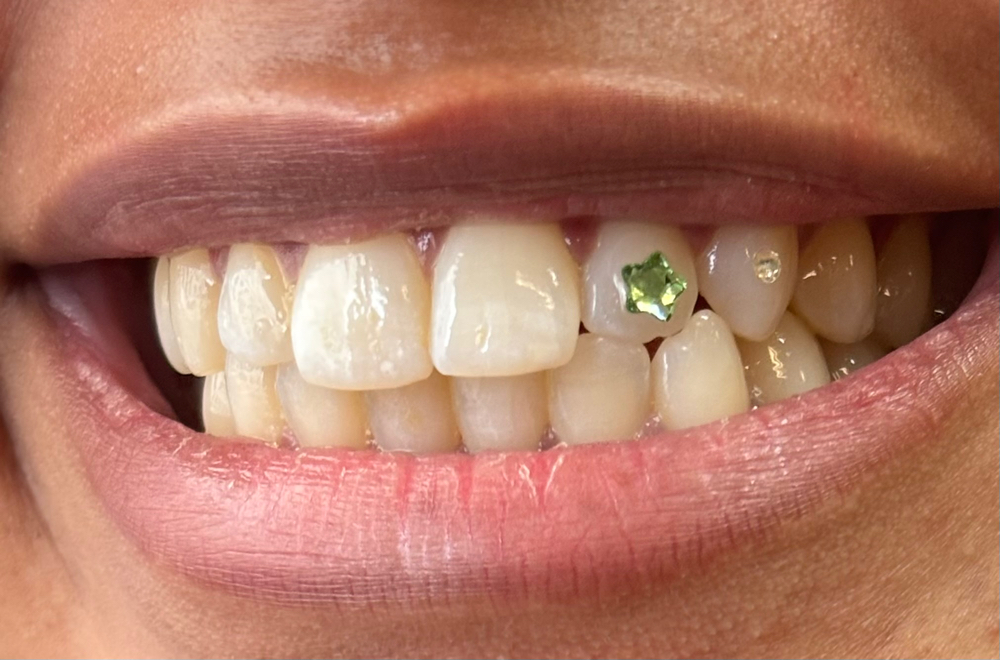 Tooth Gem Application- Designs