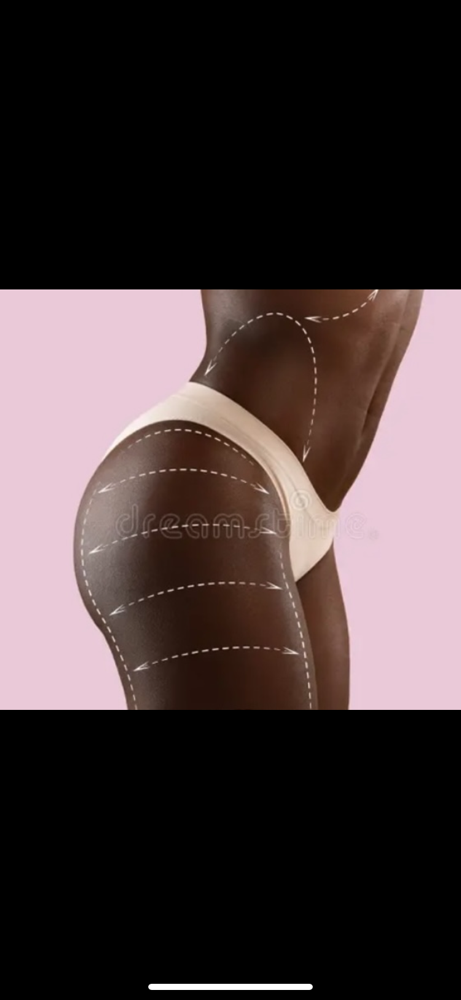 Full Body Contouring