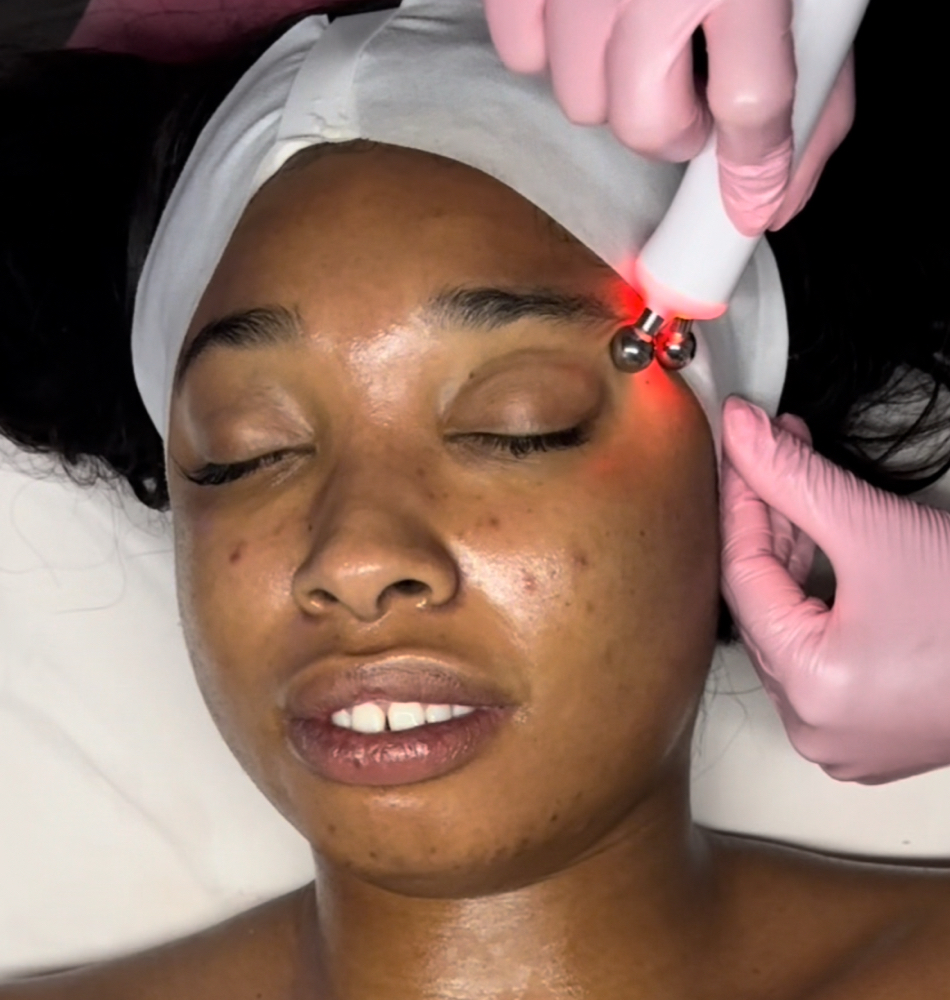 The Sculpt + Firm Facial at Zelle Aesthetics in Bedford, TX