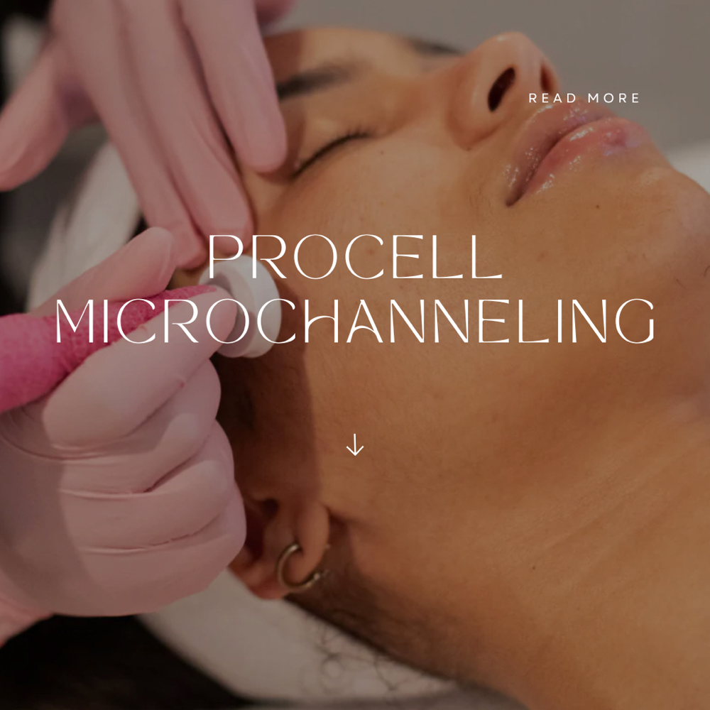 Procell Microchanneling Face