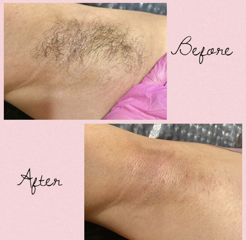 UNDERARM WAX