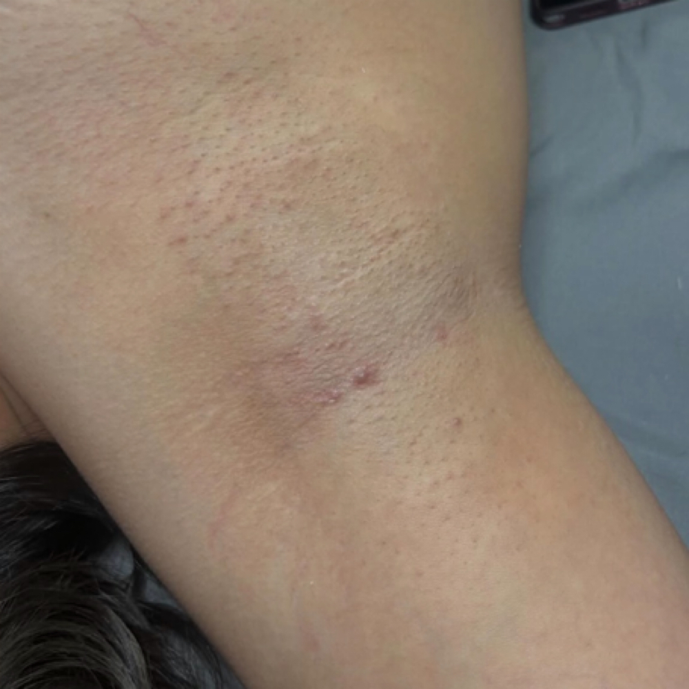 Underarm Wax at GlowWithMaleni in Tucson, AZ