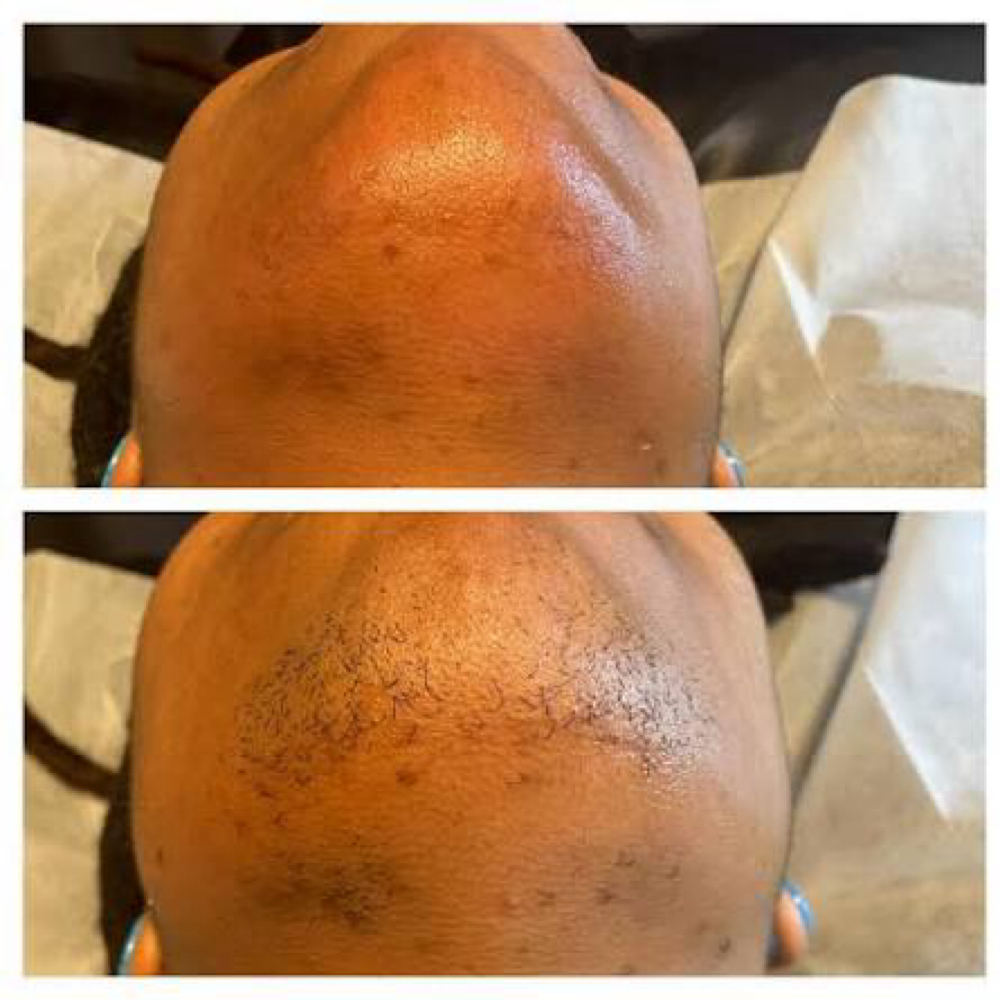 Chin - Wax at Wax Ritual Esthetic’s in Lexington, OH