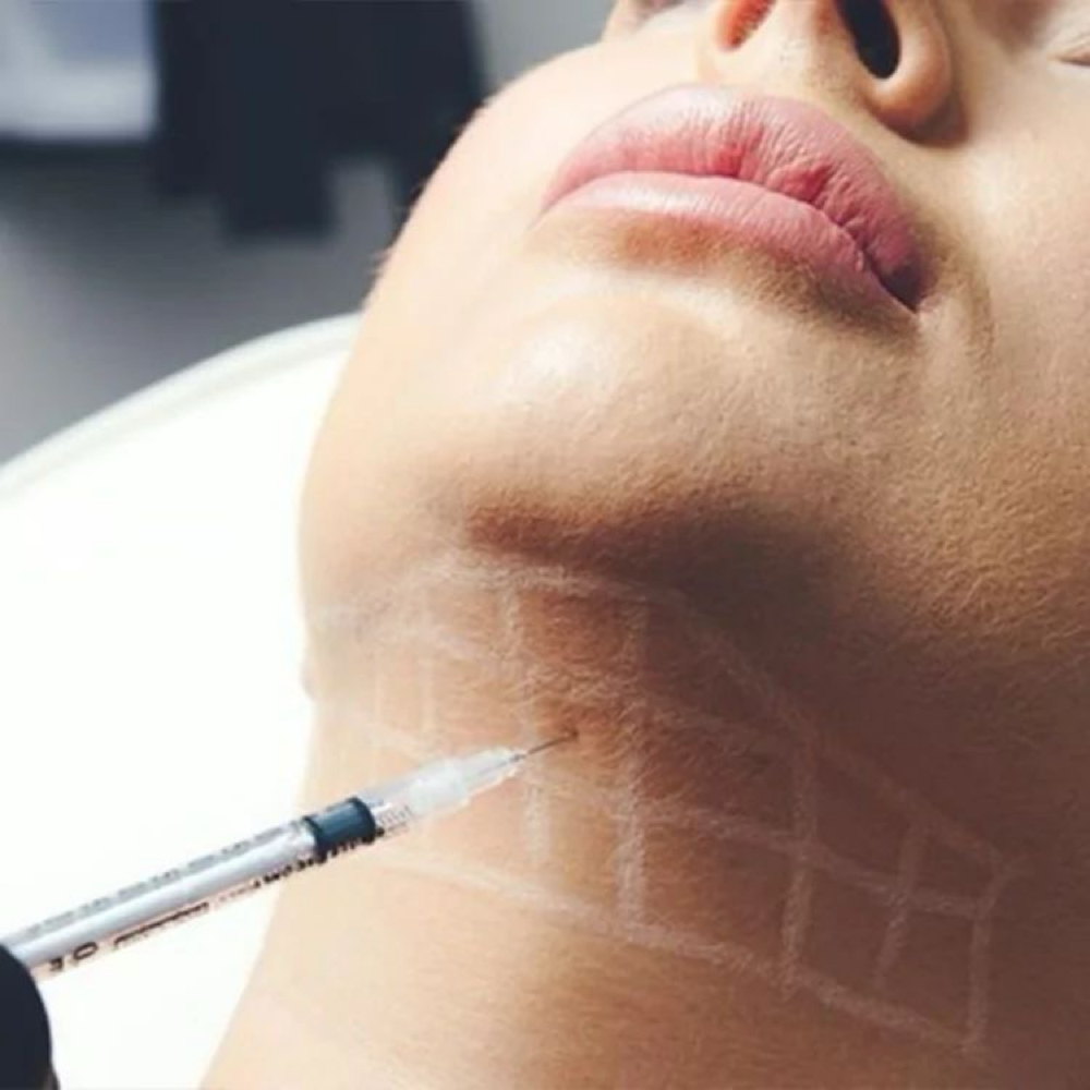 DOUBLE CHIN FAT DISSOLVER at beautybydeannette in San Antonio, TX