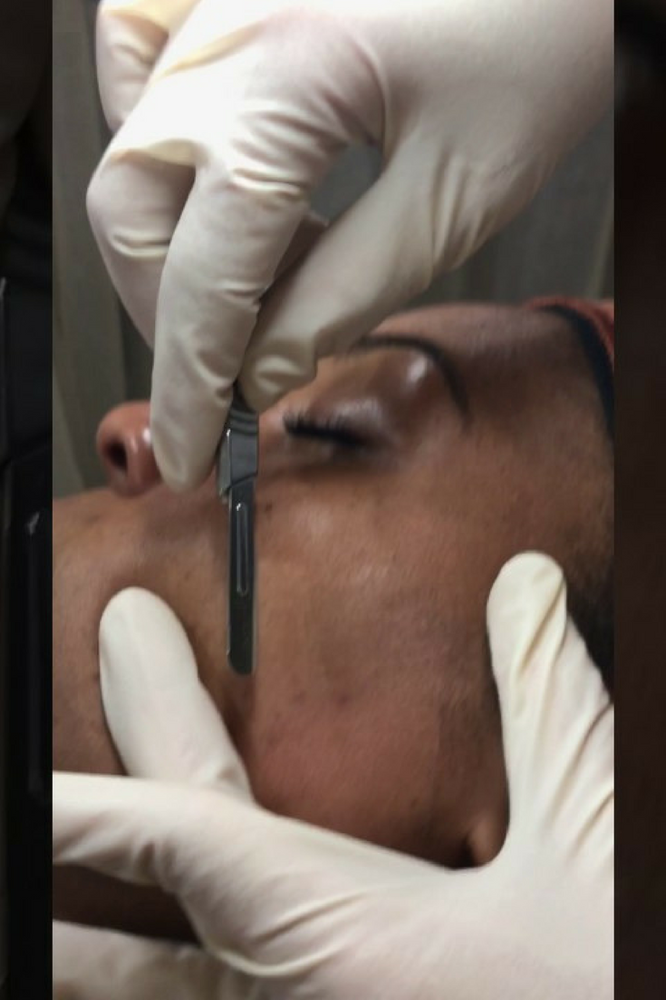 Glow Facial