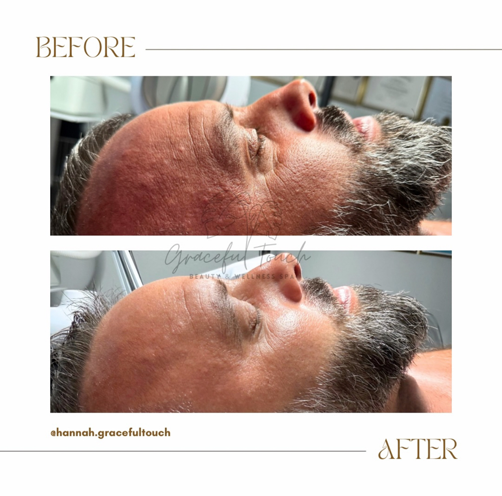 Graceful Max Hydration Facial