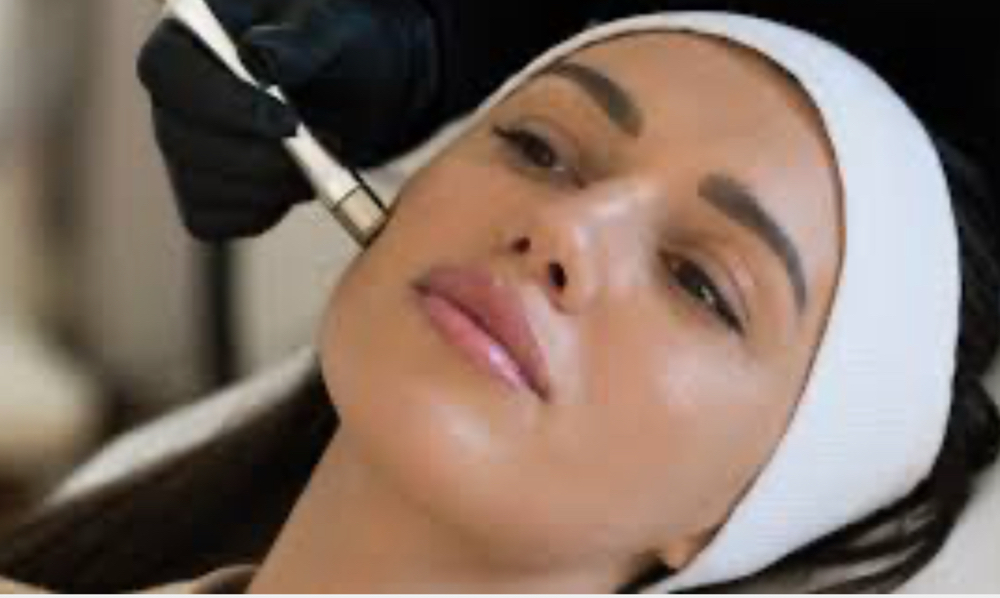 Micro Dermabrasion