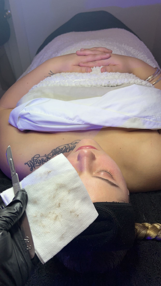 Dermaplaning Facial
