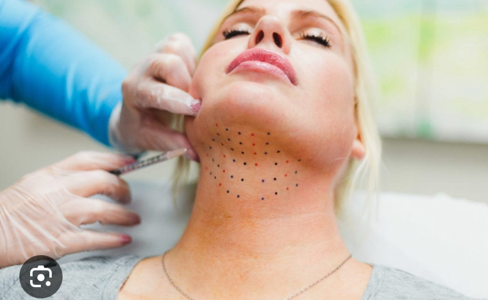 Chin And Jowls~PCDC Lipodissolve