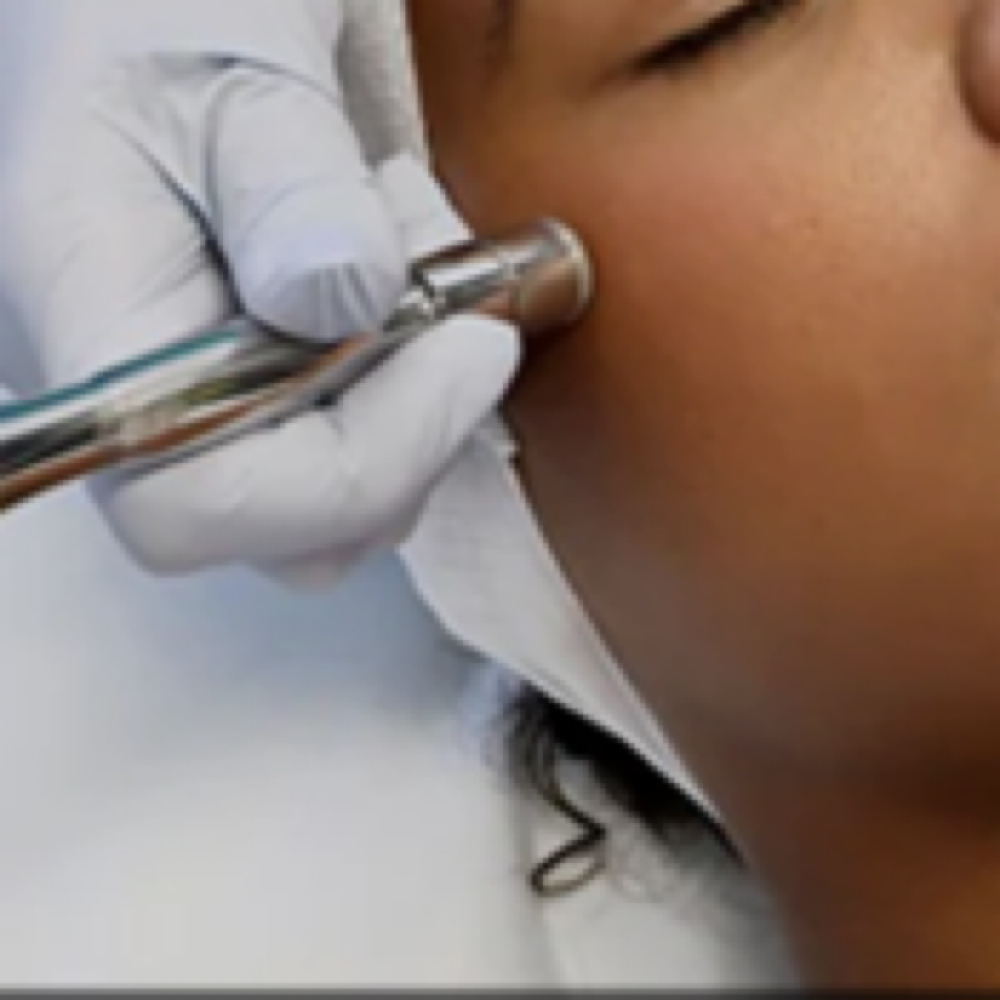 Microdermabrasion (Crystal Free) at Naturre’ Skin Care LLC in Elizabeth City, NC