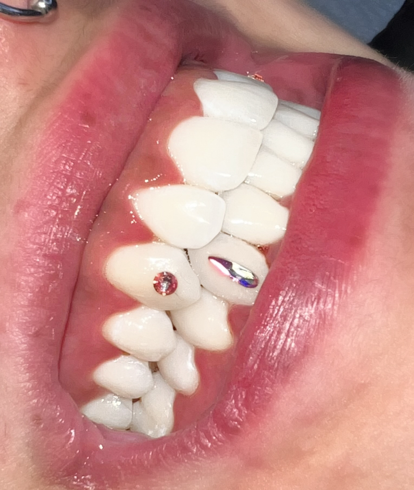 Tooth Gems (Starting @ $55)