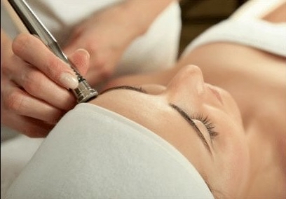 Microdermabrasion Facial