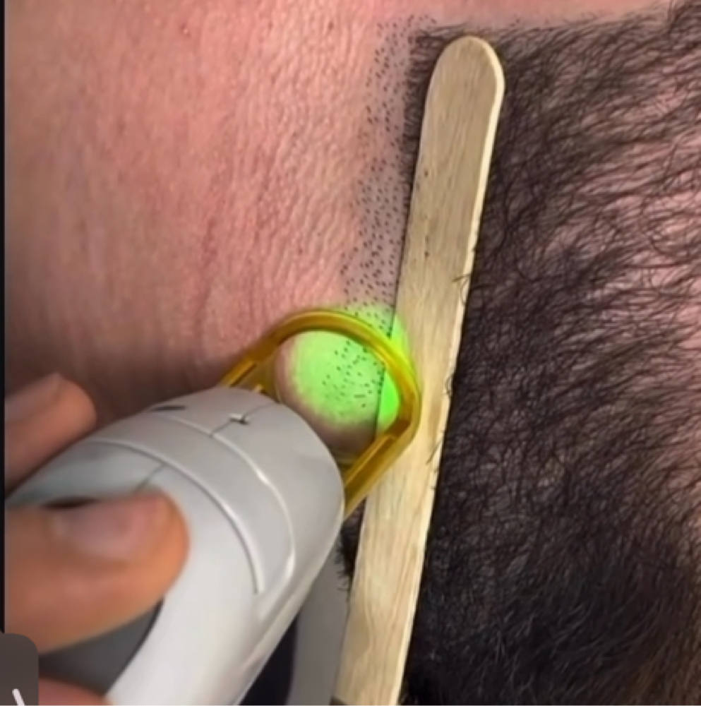 The Beard Sculpt at Corrective treatments + professional skincare in Atlanta, GA