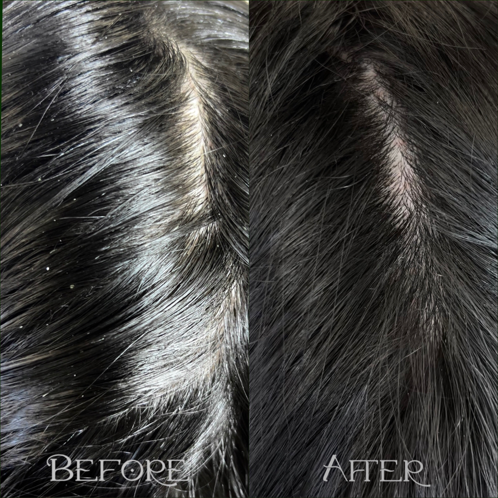 Scalp Detox Treatment