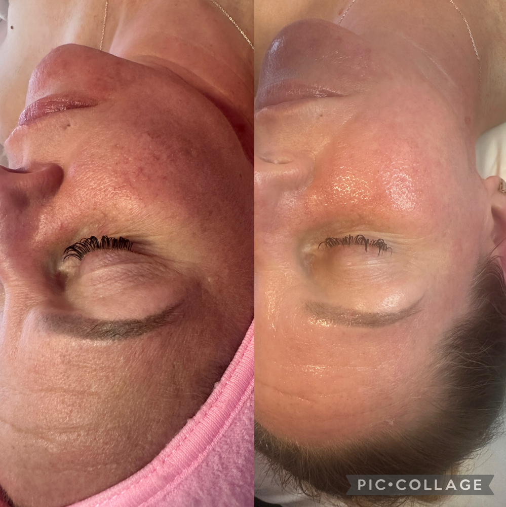 Glass Skin Facial