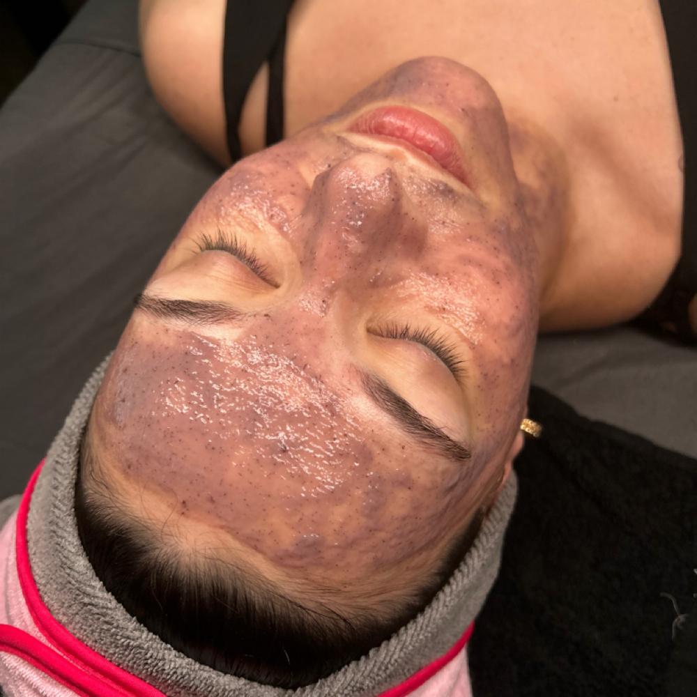 Radiance Boost Facial at Golden Moon Esthetics, LLC in Frisco, TX