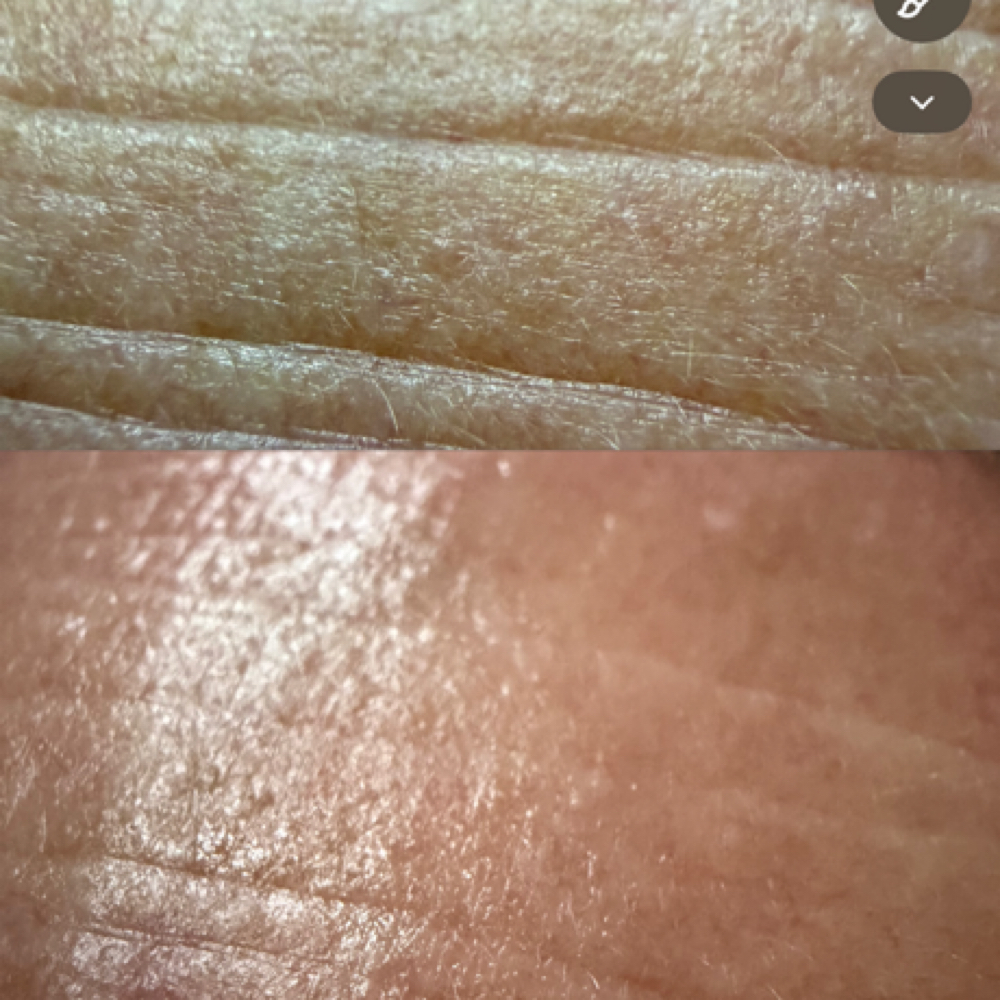 Tightening Peptide Treatment at Affinity & Glow Aesthetics in Royal Oak, MI