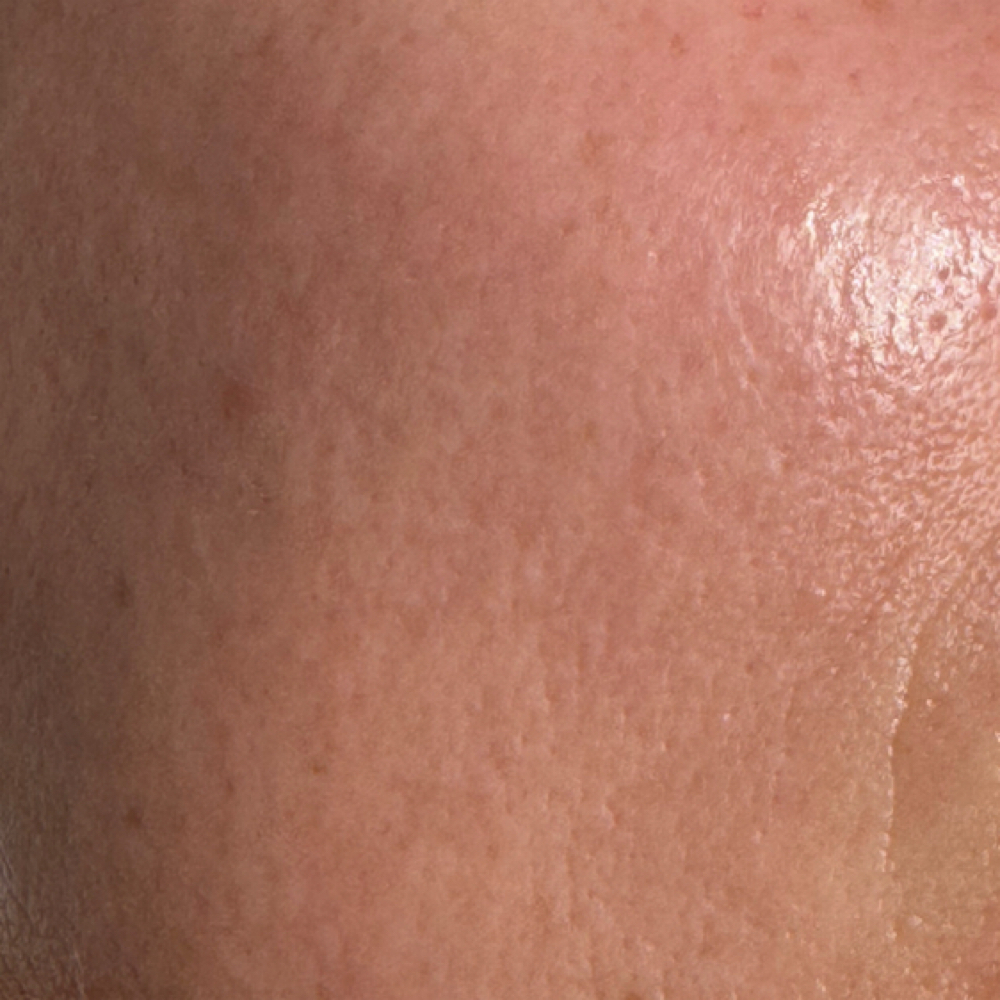Back To Calm ( Sensitive)Treatment at Pure Joi Skin in Jersey City, NJ