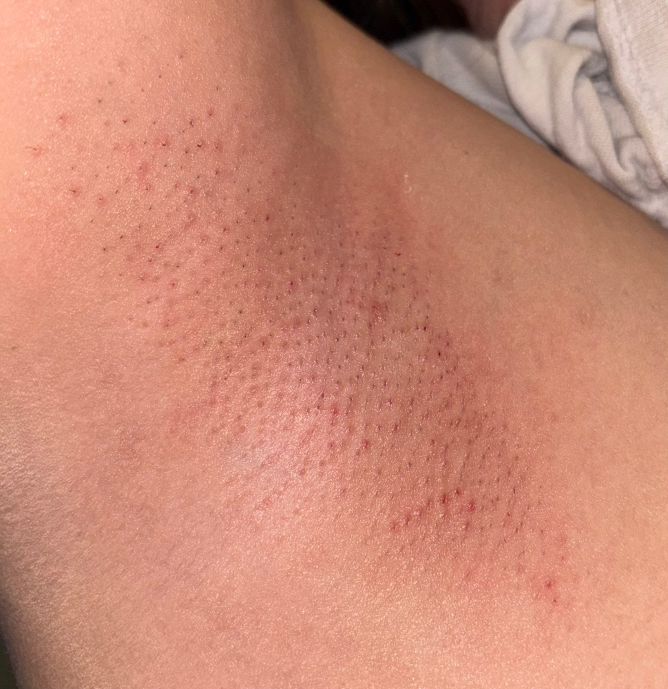 Underarm Wax