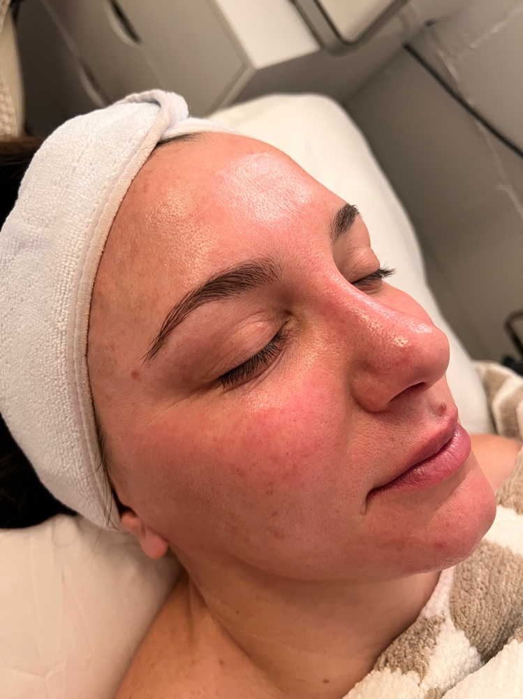 Brightening Facial