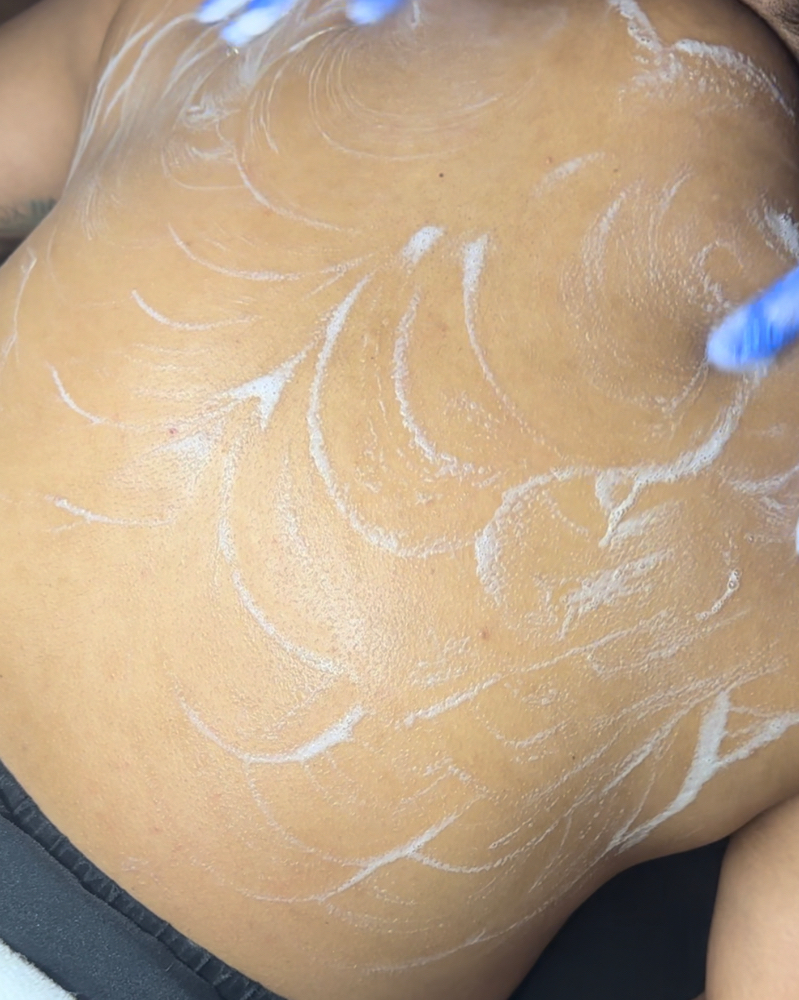 Back Facial