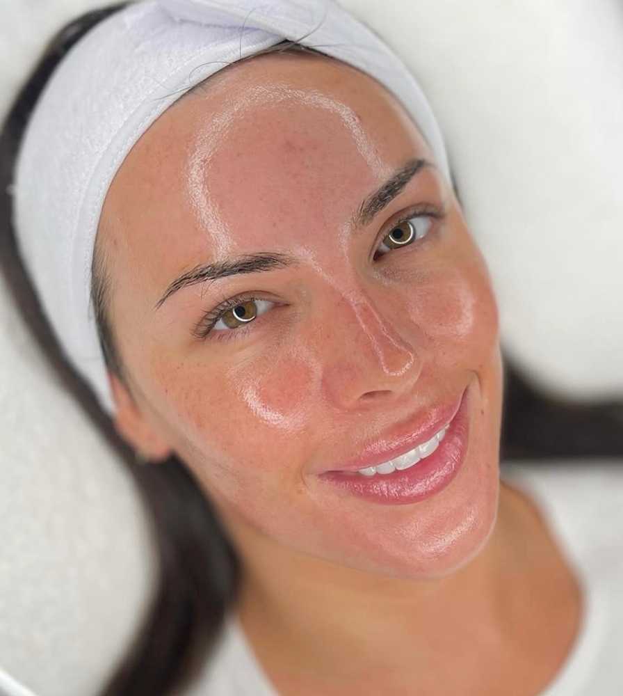 Anti-Aging Chemical Peel at The Twisted Angel Salon & Spa in Bloomington, IN