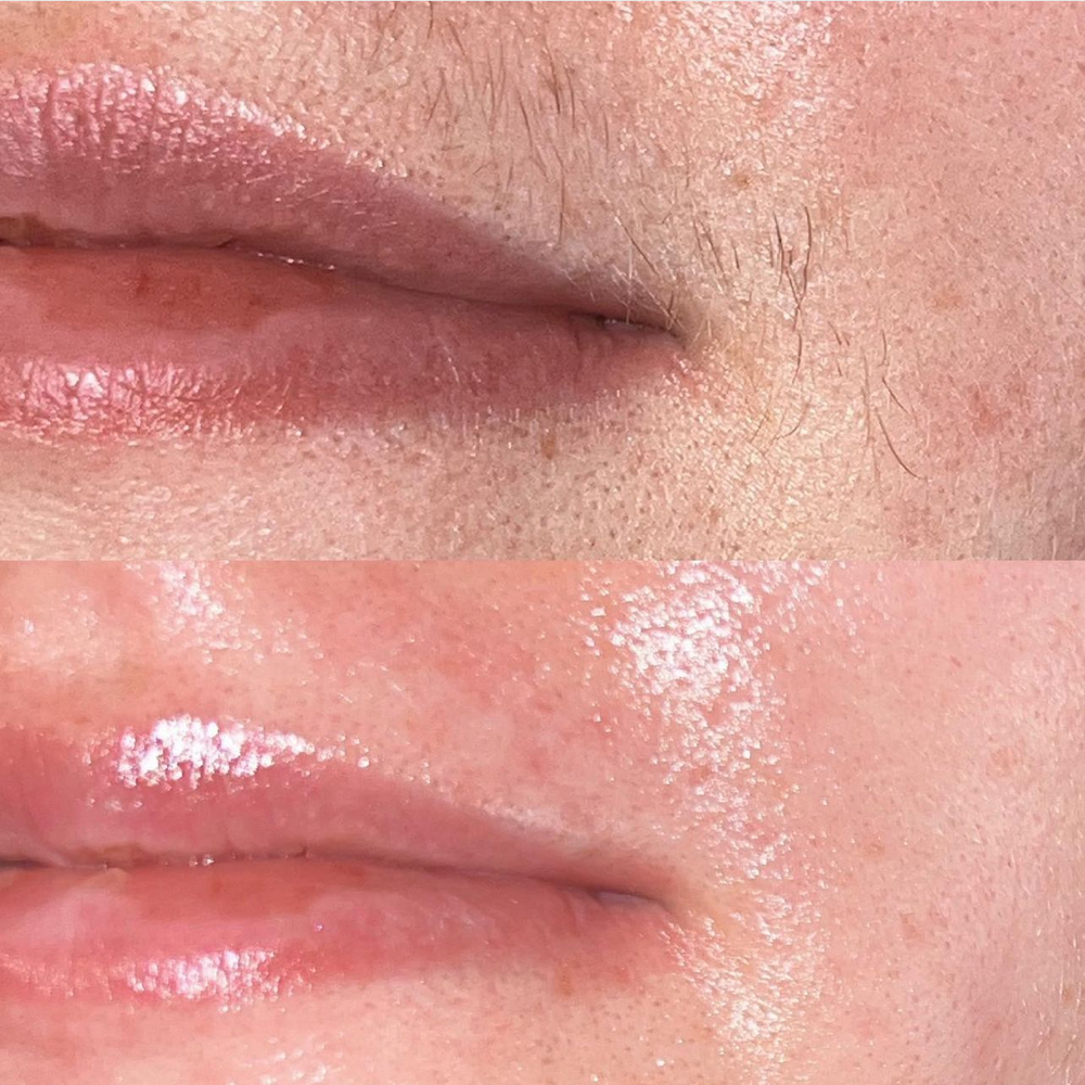 Lip Wax