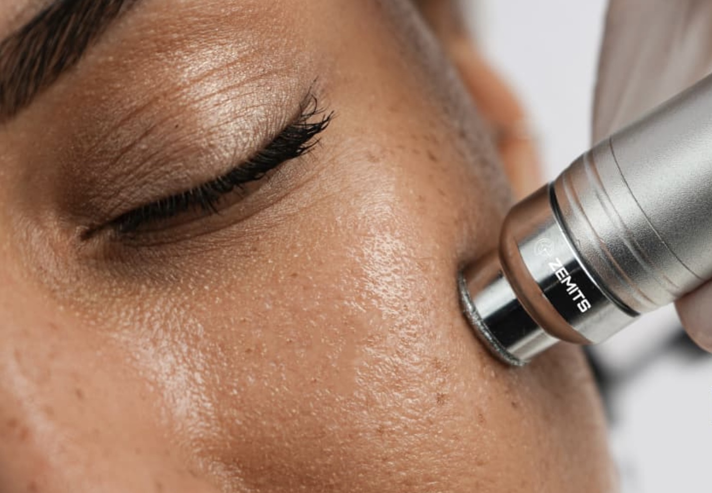 Graceful Glow Hydro-Diamond Facial