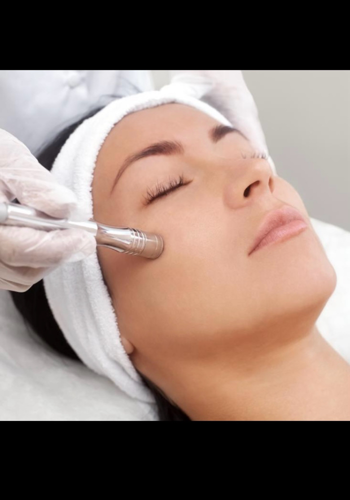 Microdermabrasion Add On