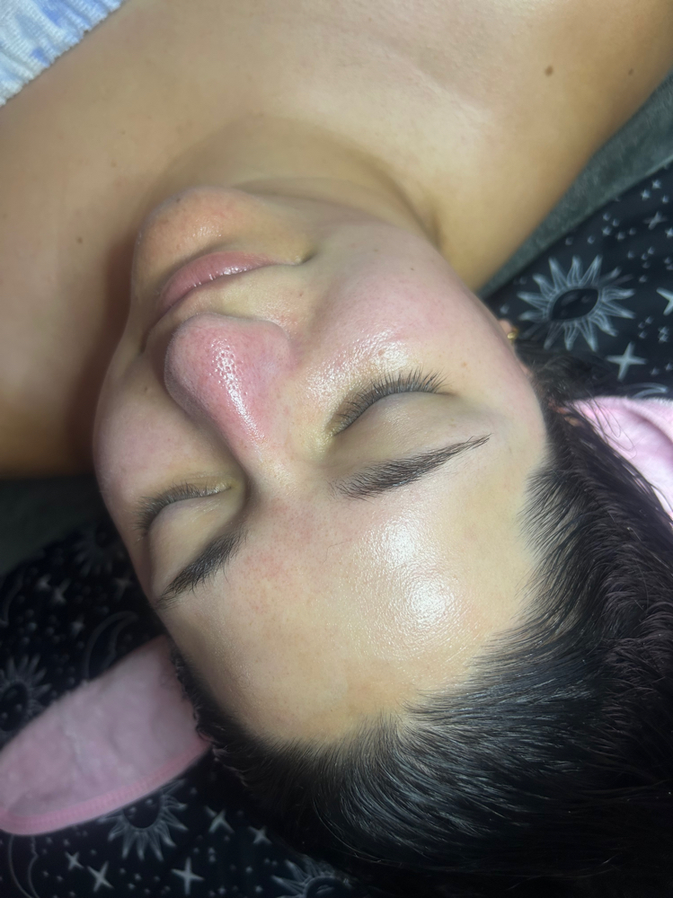 Dermaplane Deluxe