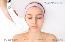IPL 30 Minutes Full Face & Neck