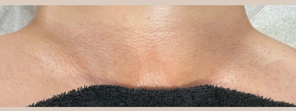 Brazilian Wax
