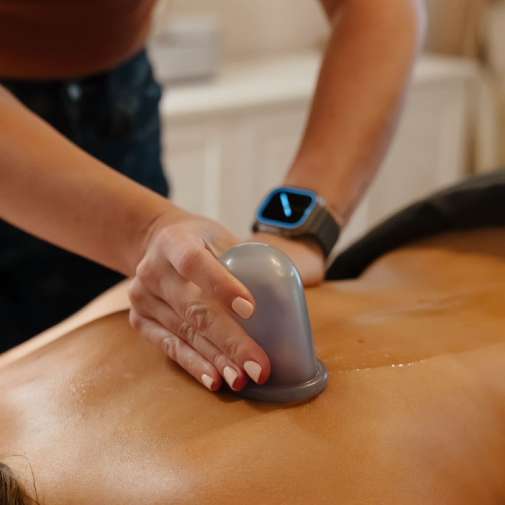 Cupping at Soule Spa + Wellness in Haddonfield, NJ