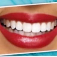 60 MIN. STANDARD 2-4 Shades Whiter
