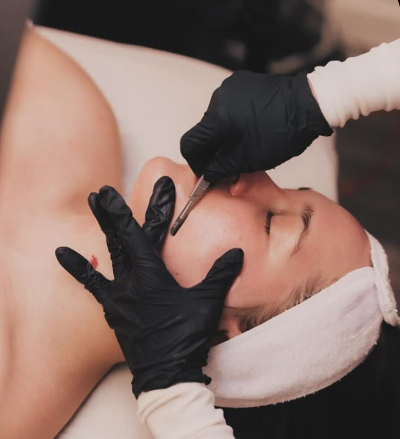 Dermaplaning Facial